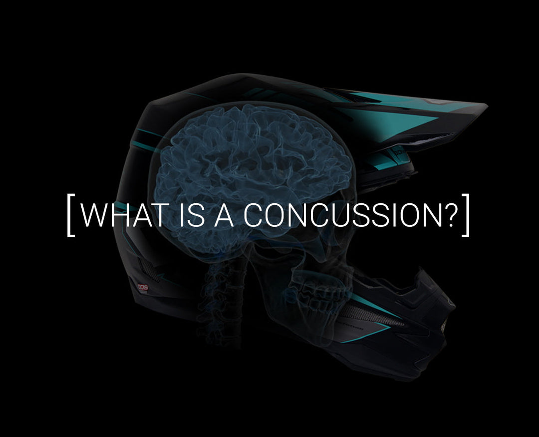 What is a Concussion?